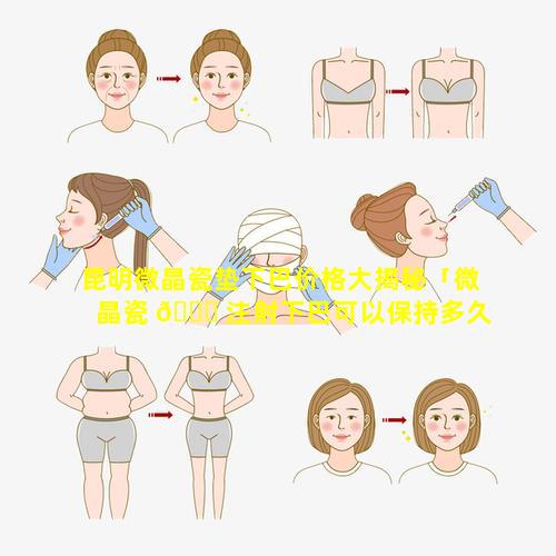 昆明微晶瓷垫下巴价格大揭秘「微晶瓷 🐛 注射下巴可以保持多久」